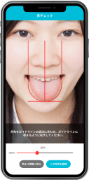 舌の様子をチェック - 撮影