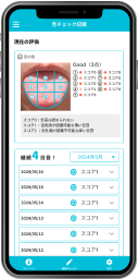 舌の様子をチェック - レポート
